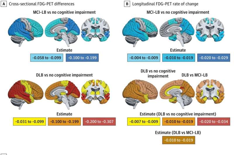7 Stages Lewy Body Dementia